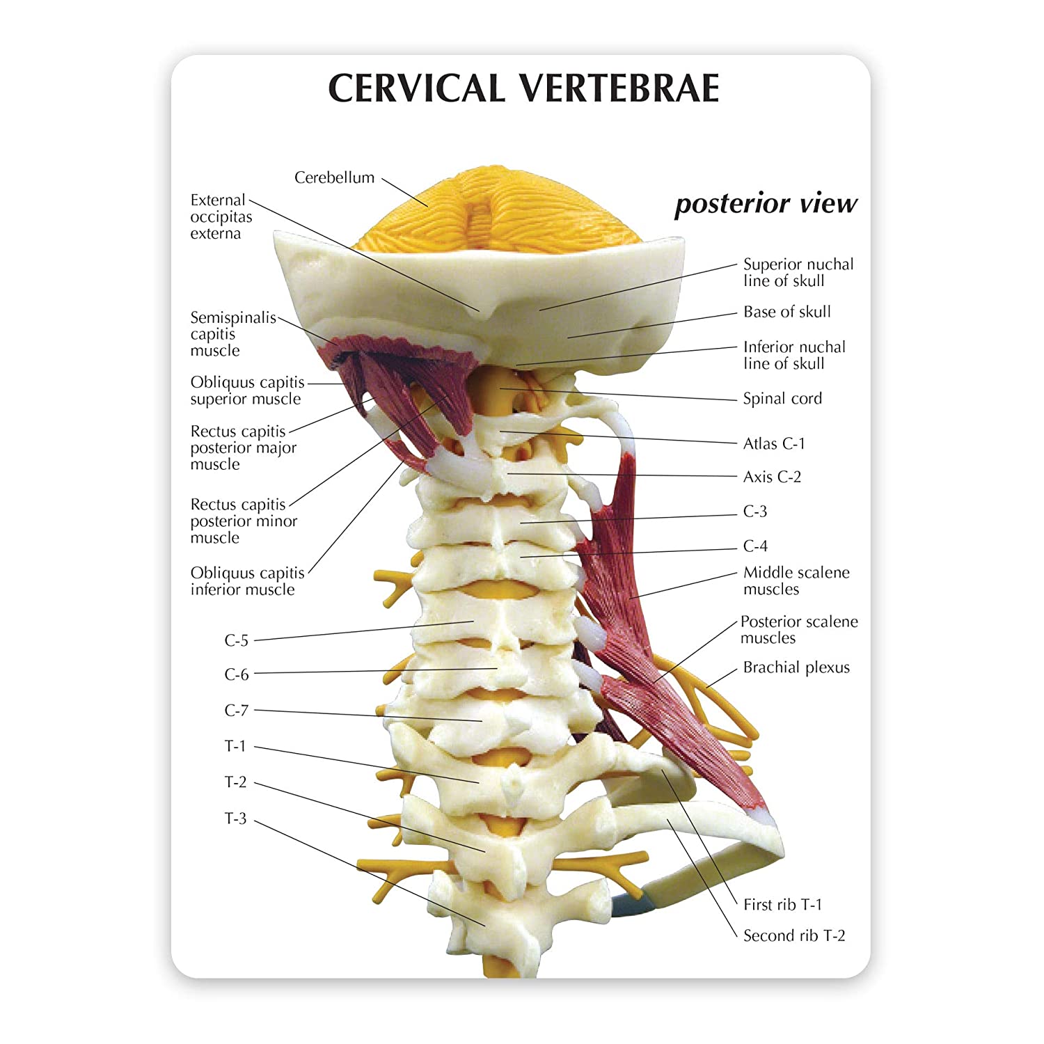 Deluxe Muscled Cervical Anatomy Model 2598